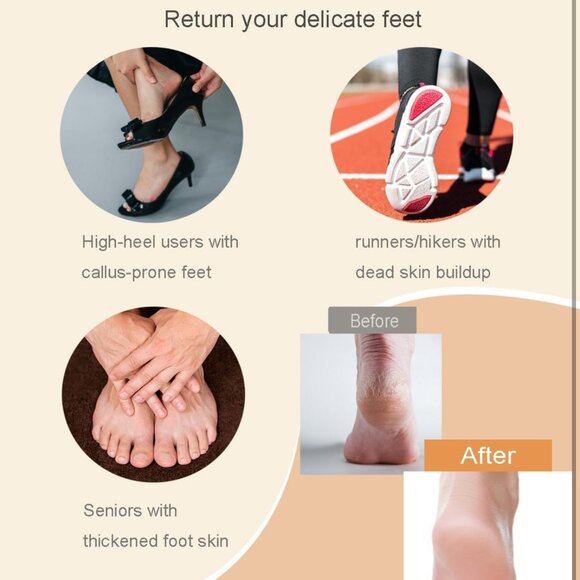 Electric Callus Remover for Feet - 2-Speed Rechargeable Pedicure Kit with 3 Roll - Picture 8 of 10